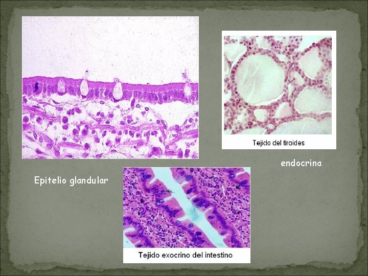 endocrina Epitelio glandular 