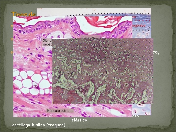Tipos de tejido cartilaginoso Cartilaginoso hialino : con pocas fibras de colágeno (nariz, cartílagos,