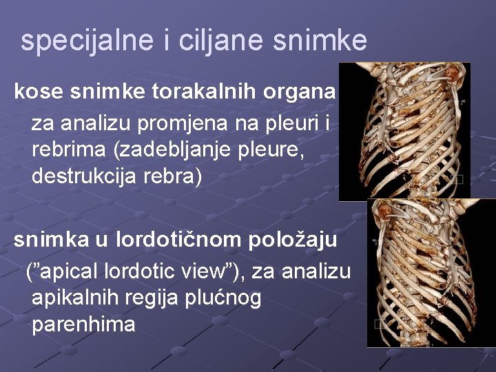 specijalne i ciljane snimke kose snimke torakalnih organa za analizu promjena na pleuri i