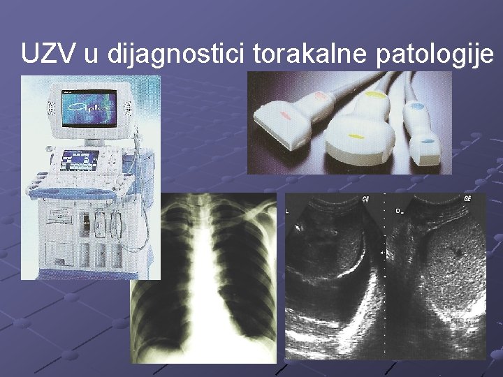 UZV u dijagnostici torakalne patologije 