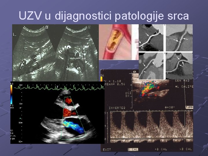 UZV u dijagnostici patologije srca 