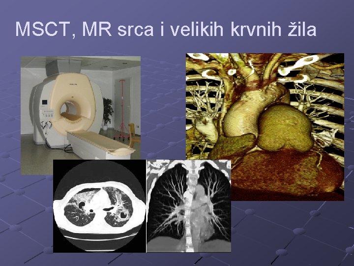 MSCT, MR srca i velikih krvnih žila 