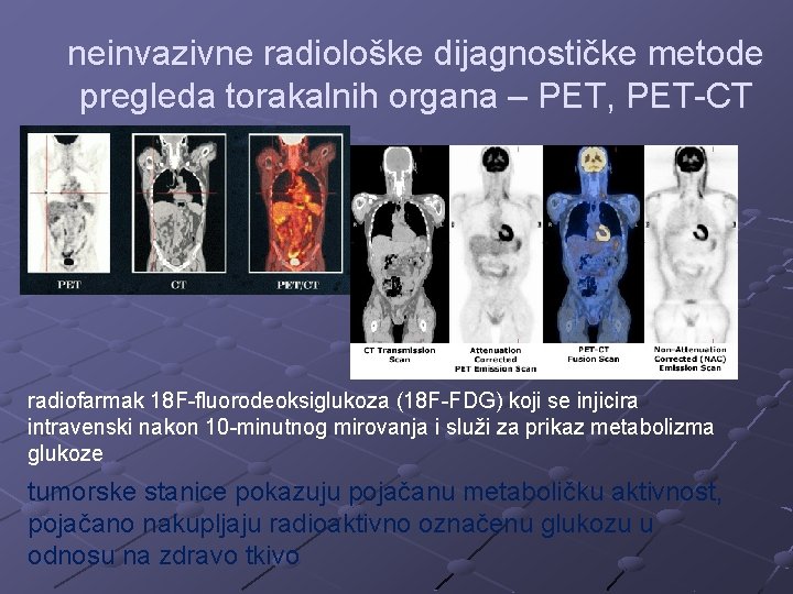 neinvazivne radiološke dijagnostičke metode pregleda torakalnih organa – PET, PET-CT radiofarmak 18 F-fluorodeoksiglukoza (18