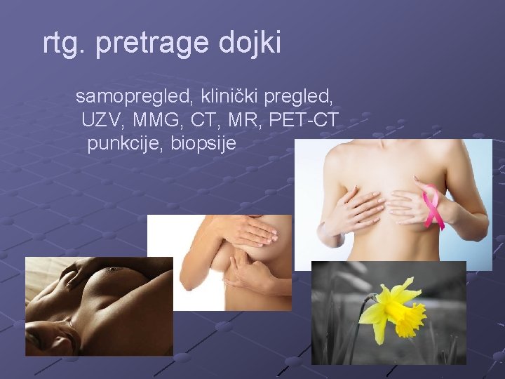 rtg. pretrage dojki samopregled, klinički pregled, UZV, MMG, CT, MR, PET-CT punkcije, biopsije 