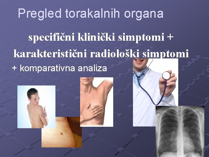 Pregled torakalnih organa specifični klinički simptomi + karakteristični radiološki simptomi + komparativna analiza 