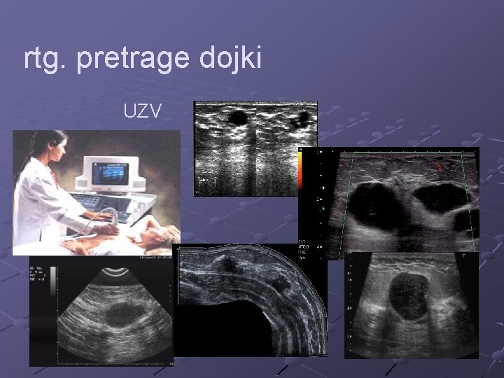 rtg. pretrage dojki UZV 