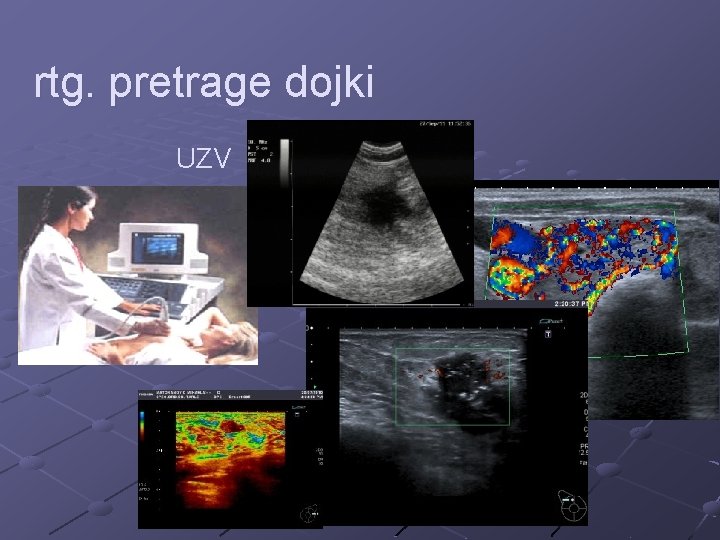 rtg. pretrage dojki UZV 