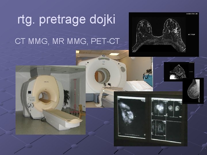  rtg. pretrage dojki CT MMG, MR MMG, PET-CT 