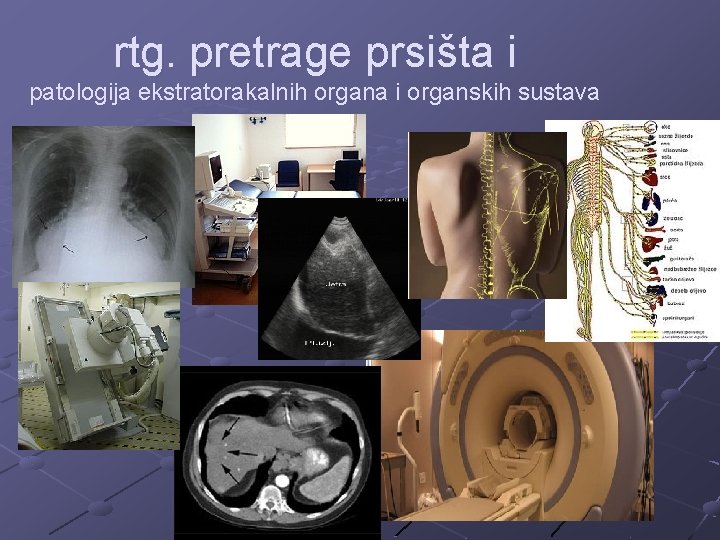 rtg. pretrage prsišta i patologija ekstratorakalnih organa i organskih sustava 
