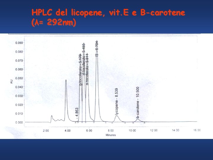 HPLC del licopene, vit. E e B-carotene (λ= 292 nm) 