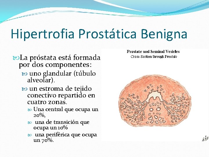 Cancer de prostata estadios, Manual Salvamari - Cancer laringe estadio 4