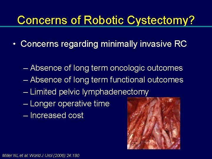 Concerns of Robotic Cystectomy? • Concerns regarding minimally invasive RC – Absence of long