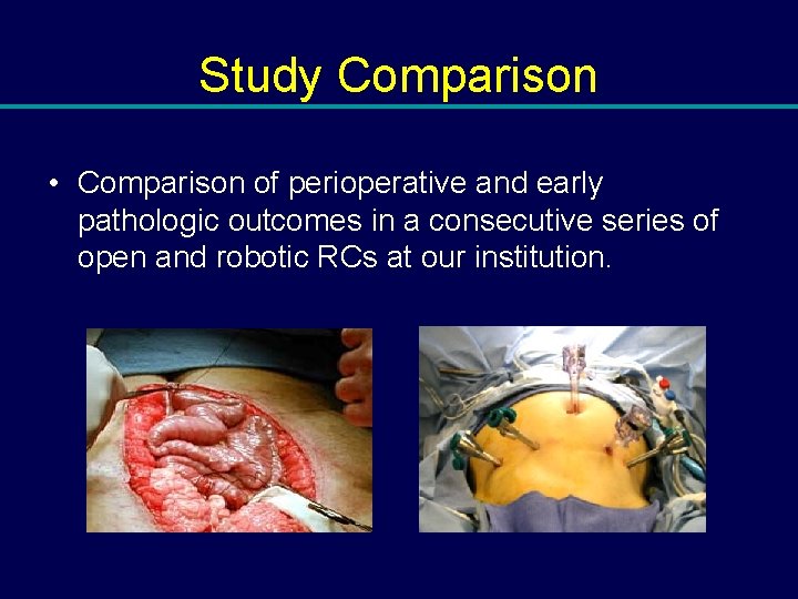 Study Comparison • Comparison of perioperative and early pathologic outcomes in a consecutive series