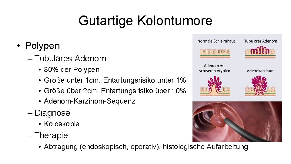 Gutartige Kolontumore • Polypen – Tubuläres Adenom • • 80% der Polypen Größe unter