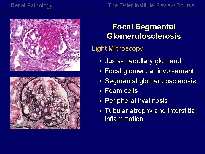 Renal Pathology The Osler Institute Review Course Focal Segmental Glomerulosclerosis Light Microscopy • •