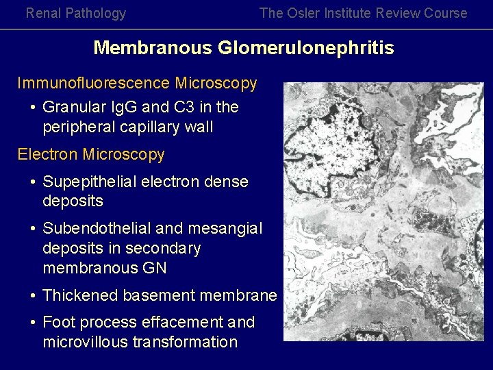 Renal Pathology The Osler Institute Review Course Membranous Glomerulonephritis Immunofluorescence Microscopy • Granular Ig.