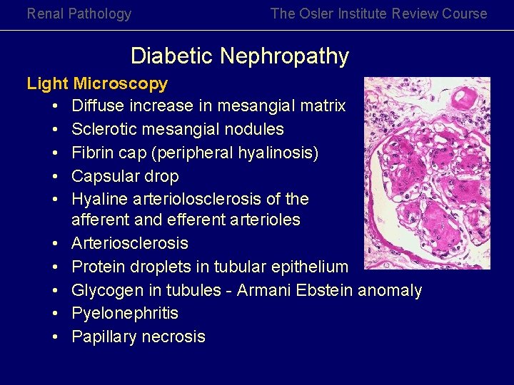 Renal Pathology The Osler Institute Review Course Diabetic Nephropathy Light Microscopy • Diffuse increase