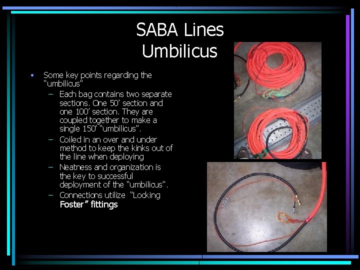 SABA Lines Umbilicus • Some key points regarding the “umbilicus” – Each bag contains