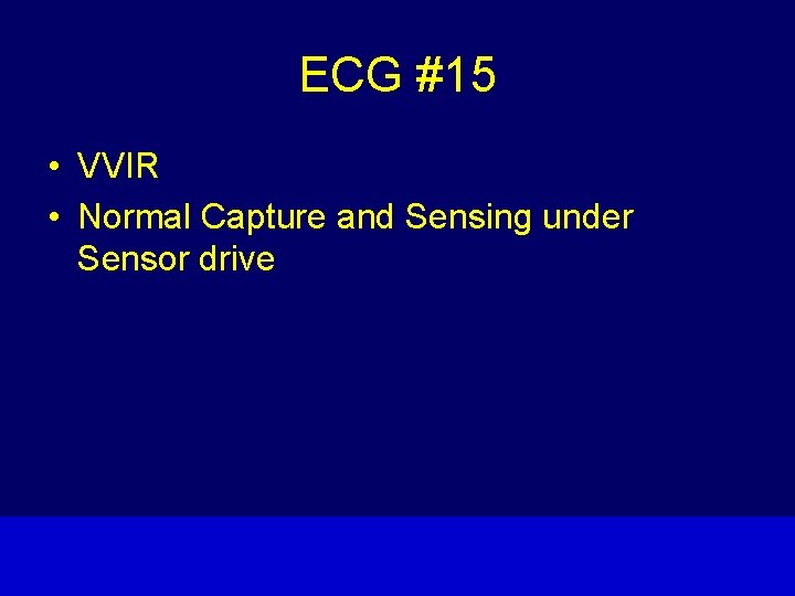 ECG #15 • VVIR • Normal Capture and Sensing under Sensor drive 15 