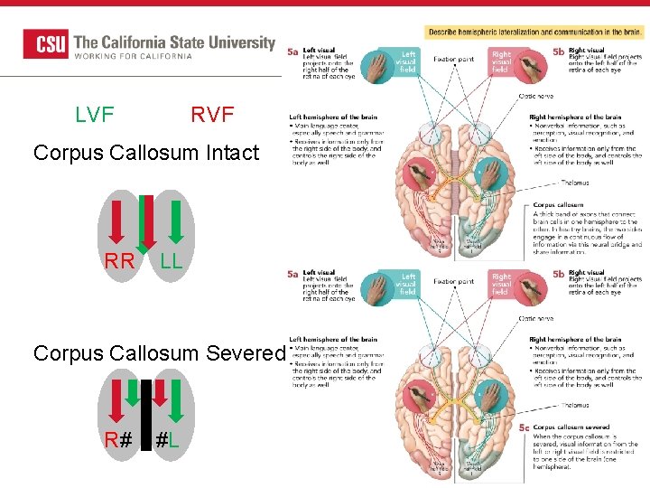 LVF RVF Corpus Callosum Intact RR LL Corpus Callosum Severed R# #L 