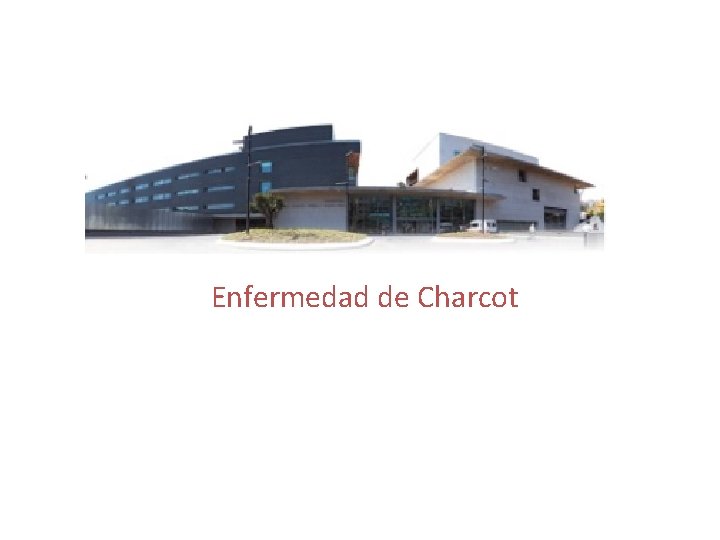 Enfermedad de Charcot 