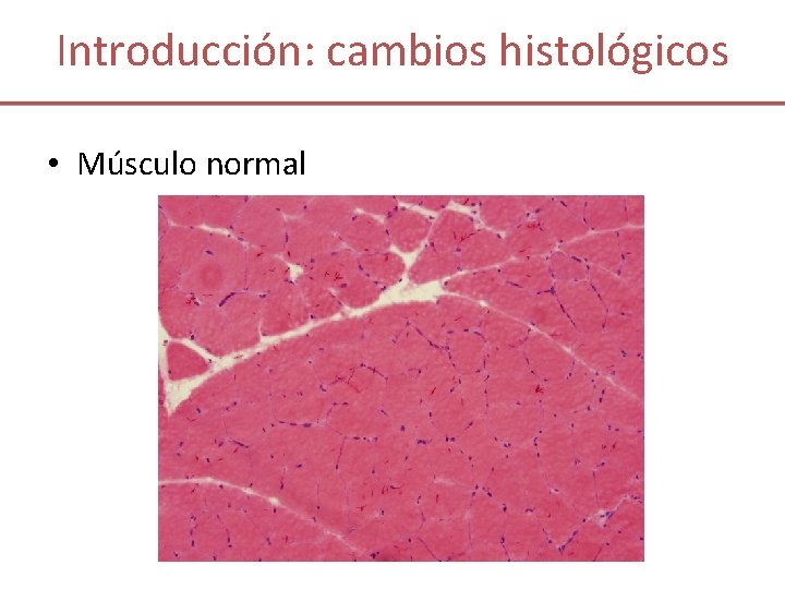 Introducción: cambios histológicos • Músculo normal 