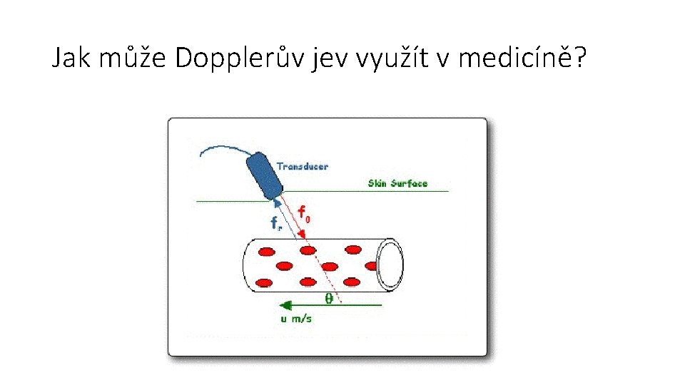 Jak může Dopplerův jev využít v medicíně? 