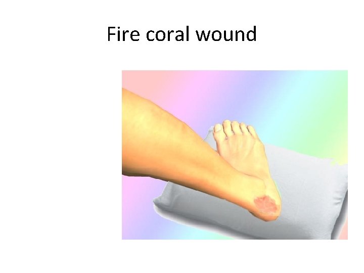 Fire coral wound 