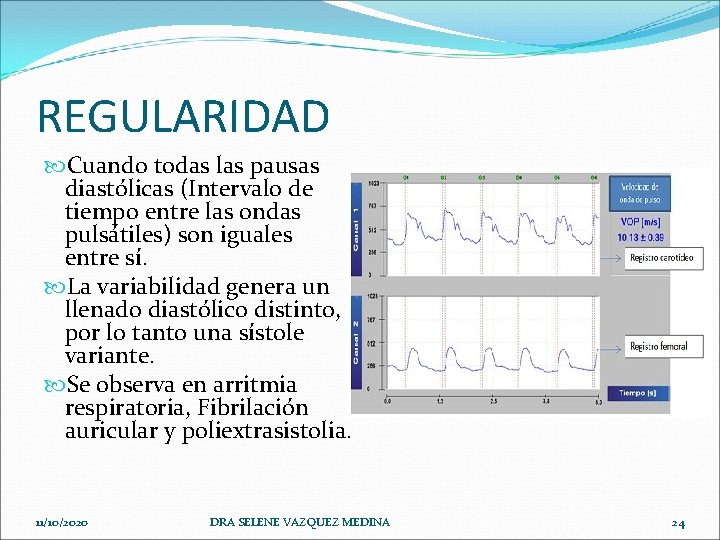 REGULARIDAD Cuando todas las pausas diastólicas (Intervalo de tiempo entre las ondas pulsátiles) son