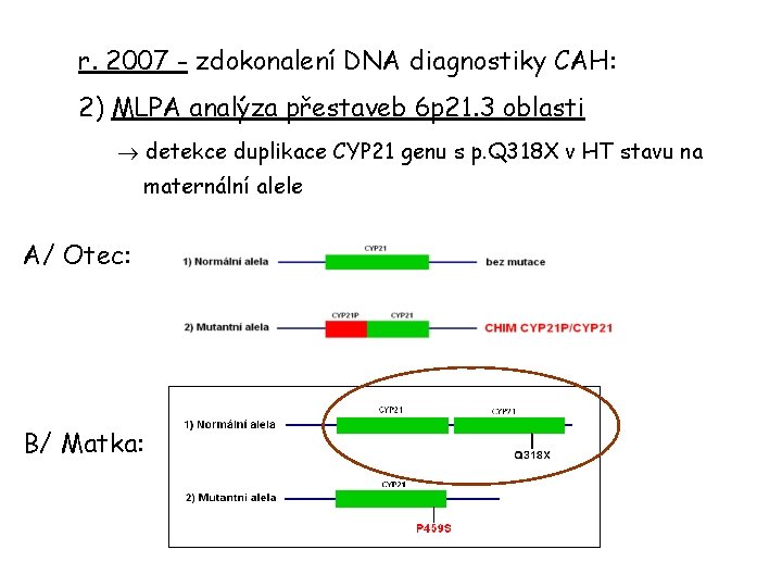 r. 2007 - zdokonalení DNA diagnostiky CAH: 2) MLPA analýza přestaveb 6 p 21.