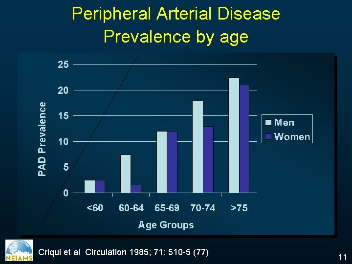 PAD Prevalence Peripheral Arterial Disease Prevalence by age Age Groups Criqui et al Circulation