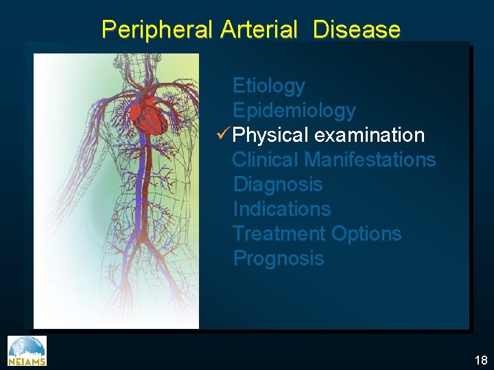 Peripheral Arterial Disease Etiology Epidemiology üPhysical examination Clinical Manifestations Diagnosis Indications Treatment Options Prognosis