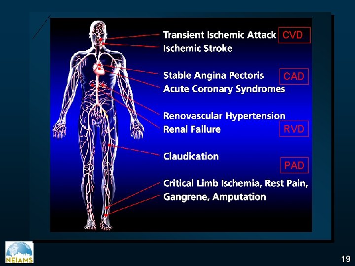 CVD CAD RVD PAD 19 