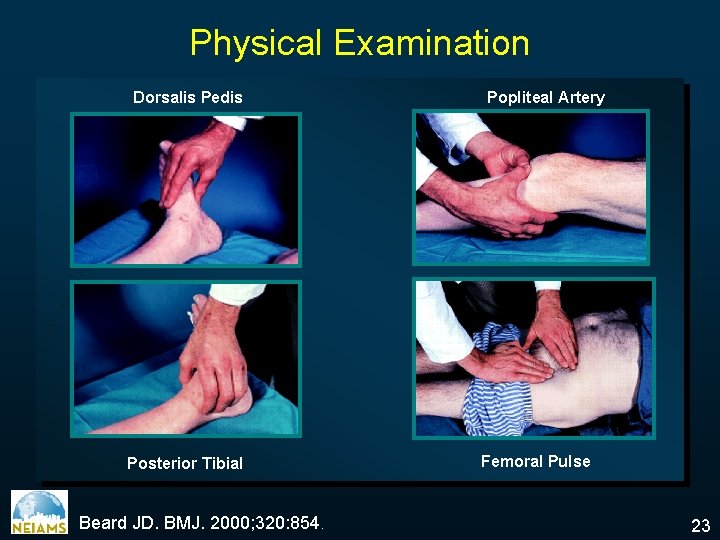 Physical Examination Dorsalis Pedis Posterior Tibial Beard JD. BMJ. 2000; 320: 854. Popliteal Artery