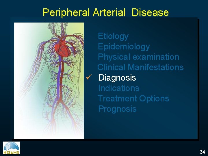 Peripheral Arterial Disease Etiology Epidemiology Physical examination Clinical Manifestations ü Diagnosis Indications Treatment Options
