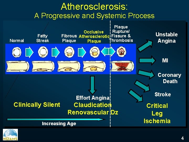 Atherosclerosis: A Progressive and Systemic Process Normal Fatty Streak Plaque Rupture/ Occlusive Fibrous Atherosclerotic