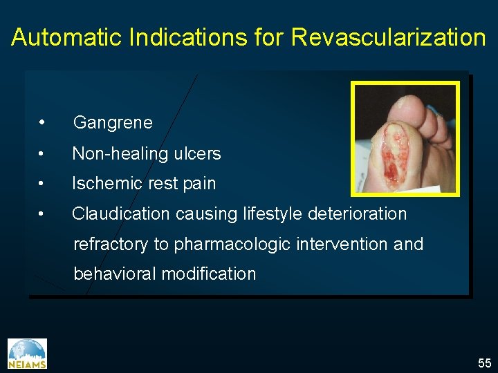 Automatic Indications for Revascularization • Gangrene • Non-healing ulcers • Ischemic rest pain •
