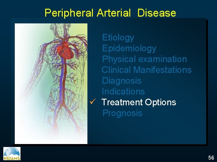 Peripheral Arterial Disease Etiology Epidemiology Physical examination Clinical Manifestations Diagnosis Indications ü Treatment Options