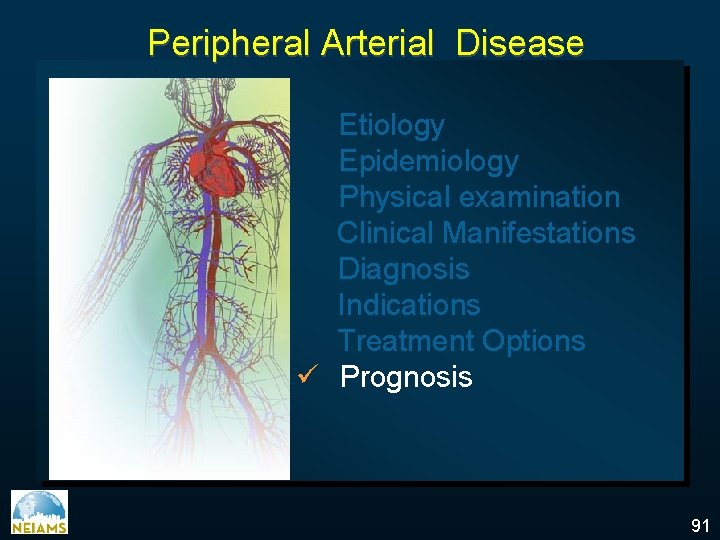 Peripheral Arterial Disease Etiology Epidemiology Physical examination Clinical Manifestations Diagnosis Indications Treatment Options ü