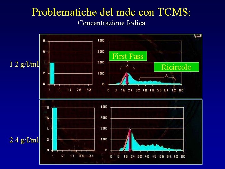 Problematiche del mdc con TCMS: Concentrazione Iodica 1. 2 g/I/ml 2. 4 g/I/ml First