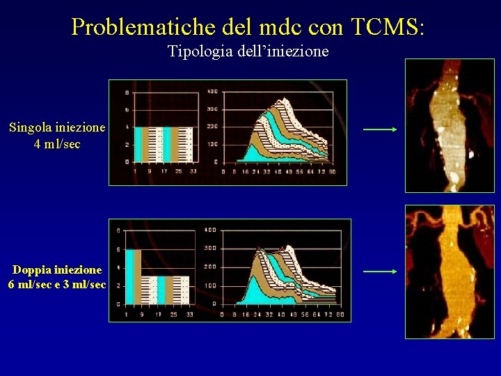 Problematiche del mdc con TCMS: Tipologia dell’iniezione Singola iniezione 4 ml/sec Doppia iniezione 6