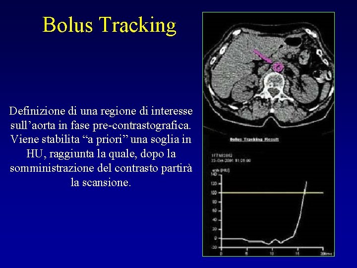 Bolus Tracking Definizione di una regione di interesse sull’aorta in fase pre-contrastografica. Viene stabilita