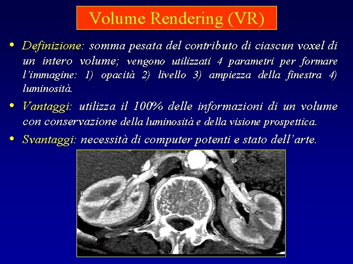 Volume Rendering (VR) • Definizione: somma pesata del contributo di ciascun voxel di un