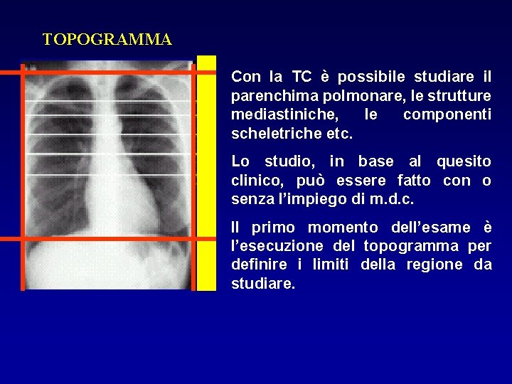 TOPOGRAMMA Con la TC è possibile studiare il parenchima polmonare, le strutture mediastiniche, le