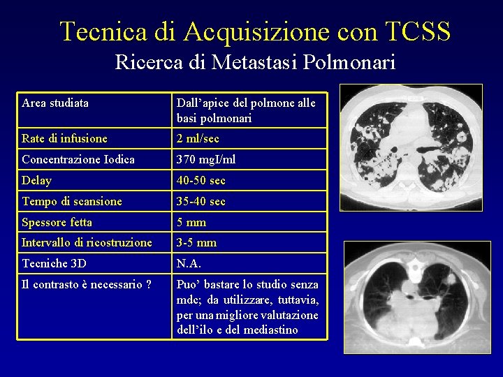 Tecnica di Acquisizione con TCSS Ricerca di Metastasi Polmonari Area studiata Dall’apice del polmone