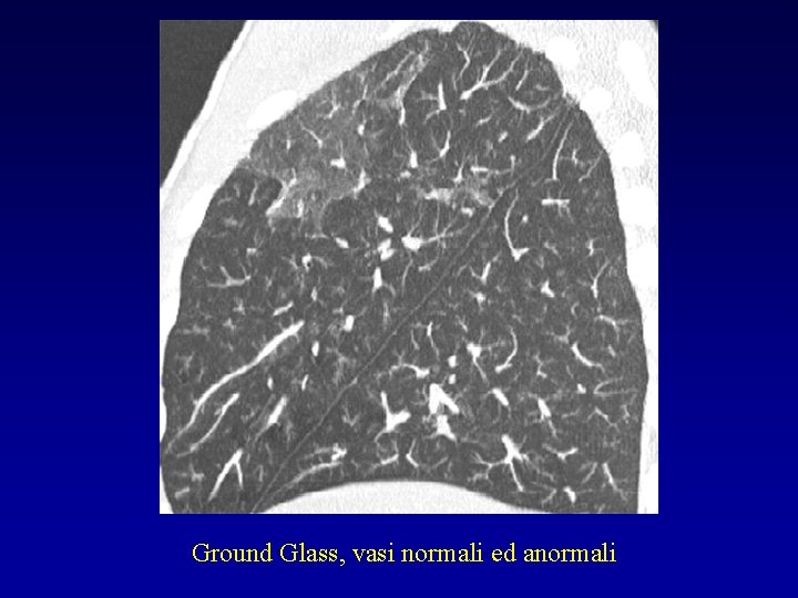 Ground Glass, vasi normali ed anormali 