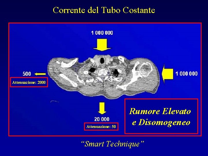 Corrente del Tubo Costante Attenuazione: 2000 Attenuazione: 50 Rumore Elevato e Disomogeneo “Smart Technique”