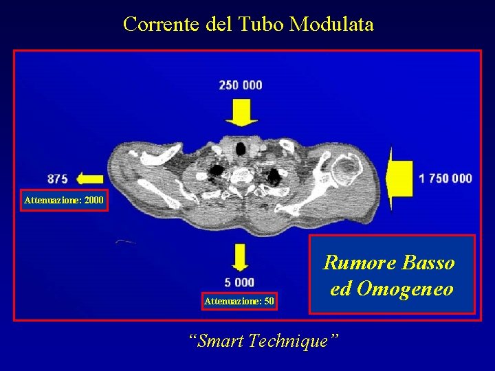 Corrente del Tubo Modulata Attenuazione: 2000 Attenuazione: 50 Rumore Basso ed Omogeneo “Smart Technique”