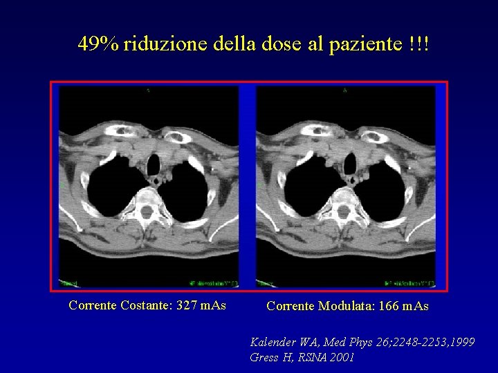 49% riduzione della dose al paziente !!! Corrente Costante: 327 m. As Corrente Modulata: