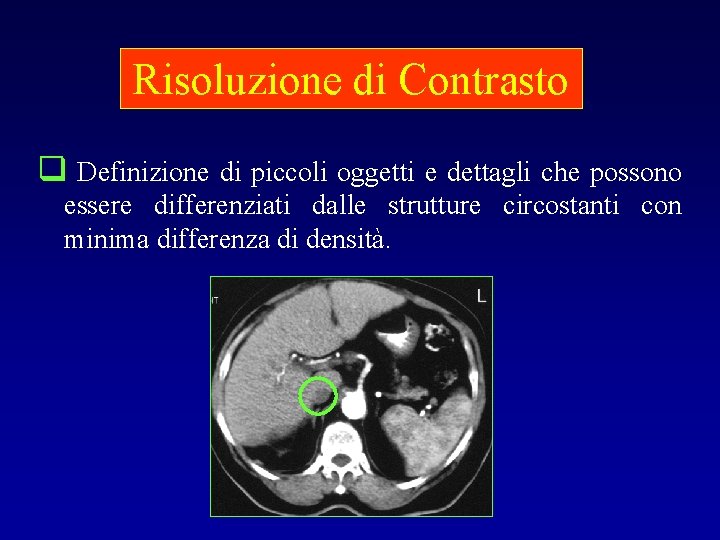 Risoluzione di Contrasto q Definizione di piccoli oggetti e dettagli che possono essere differenziati